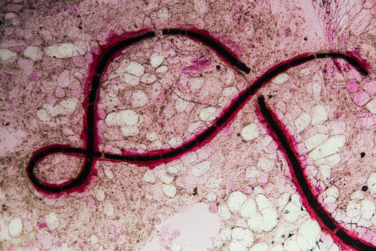 dragon fruit juice cells