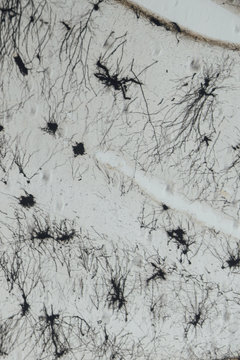 nerve cells