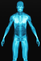 X-ray scan of the human body