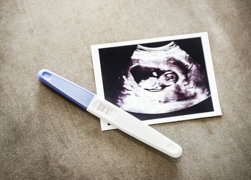 Baby ultrasound scan photo with pregnancy test