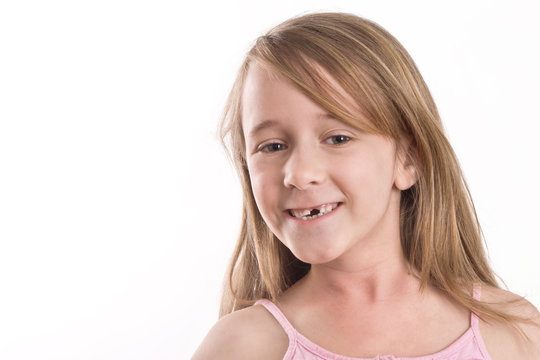 young girl showing off her missing front tooth