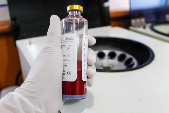 Hemoculture bottles