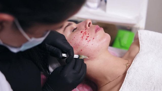 Anti-aging procedure: professional cosmetologist makes multiple injections in woman's face skin during mesotherapy. Biorevitalization and face lifting