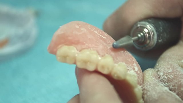 Denturist working on deture prothese