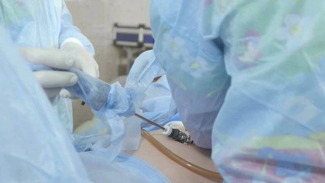 Surgeons follow the laparoscopic surgery