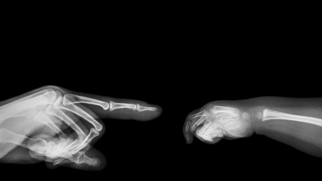 X-ray adult's hand point finger at left side and baby's hand at right side. Blank area at upper side