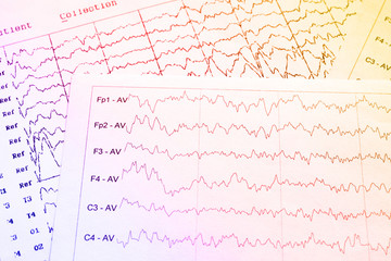 EEG electrophysiological monitoring method. EEG wave in human brain, Brain wave patterns on...