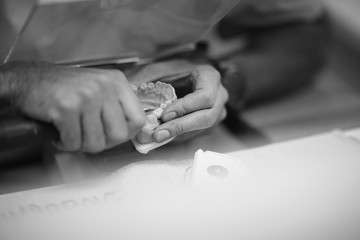 The process of manufacturing dentures in the dental laboratory
