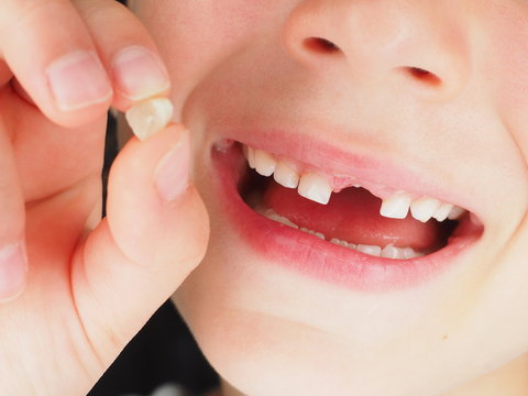 Little young girl holding lost tooth between fingers whilst smiling at closeup