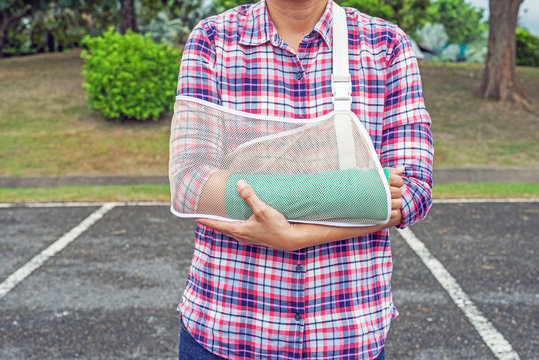 Injured Woman With Broken Arm Wearing An Arm Sling And Green Cast On Arm