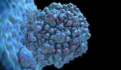 3d illustration of a brain cancer cell