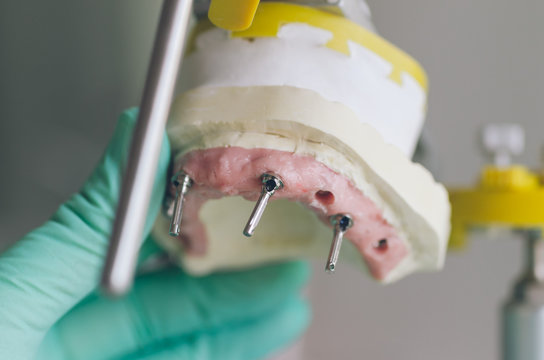 Dental