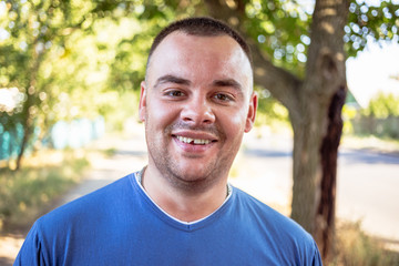 Young man in a blue T-shirt with a chipped tooth
