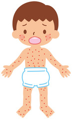 Obraz premium 突発性発疹の子供