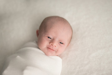 A Baby Girl With Downs Syndrome Smiles