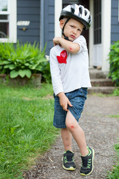 Five year old with helmet shows off his scrapes