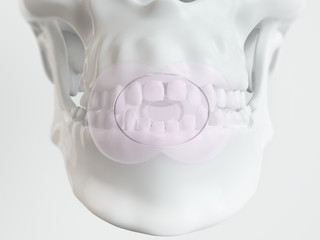 Open bite by pacifiers - 3D rendering © crevis