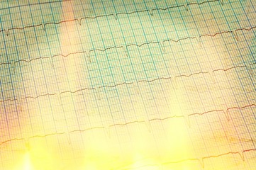 Heart analysis, electrocardiogram graph (ECG)
