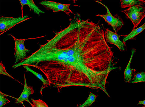 Fluorescence Microscope Image Of Bovine Pulmonary Artery Endothelial Cells BPAE Stained For Mitochondria, Phalloidin, And Nuclei Undergoing Mitosis