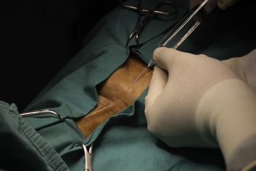 A doctor injecting local anesthetic drug