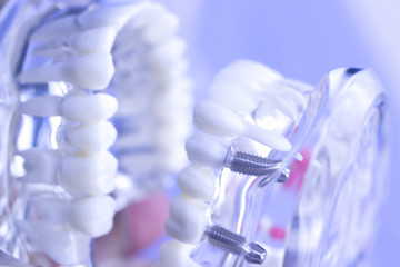 Dental teeth mouth model