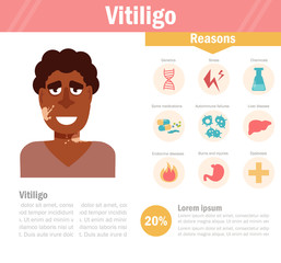 Vitiligo. Pigmentation disorders. Isolated