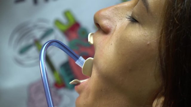 Close-up of young woman with expander in mouth during inspection of oral cavity. A young girl in the dental clinic. Professional lighting