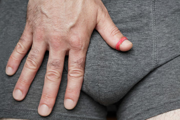 Phimosis- theme interpretation A/ An abnormal tightness of the foreskin preventing retraction over the glans