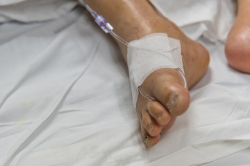 Obraz na płótnie Canvas Patient in the hospital with saline intravenous