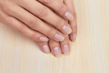 Naklejka premium Female hands with not polished nails. Woman hands without gel on nails. Young woman hands before having manicure.