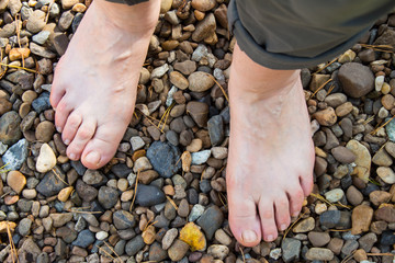 Natural physiotherapy for flat feet. Female feet on the surface of the pebbles  as prevention against platypodia