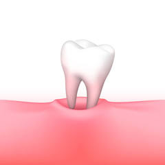 Tooth loss on white background. Vector illustration