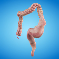 3d rendered medically accurate illustration of an opstipated colon