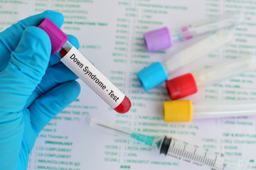 Blood sample for Down syndrome test
