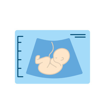 Ultrasound Of Baby With Umbilical Cord