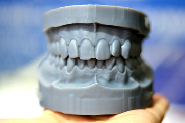 Upper and lower jaw of a man printed on a 3d printer of photopolymer. Stereolithography 3D printer, technology of liquid photopolymerization under UV light. Modern medical technologies © mari1408