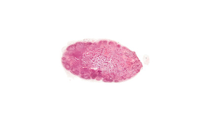 Obraz na płótnie Canvas cross section cut of lymph under the microscope
