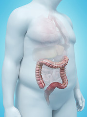 Fototapeta premium 3d rendered medically accurate illustration of an overweight mans colon