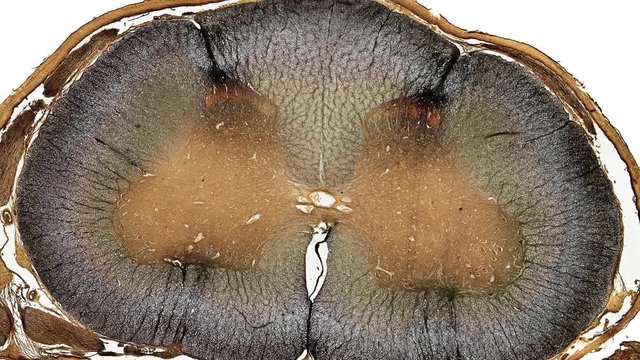 microscopic cross section of spinal cord