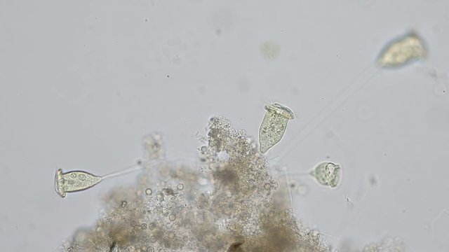 Vorticella is a genus of protozoan under the microscope view.