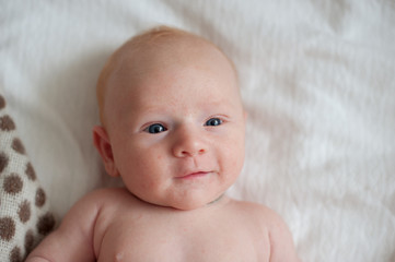 Newborn baby with a rash on the face, dermatitis