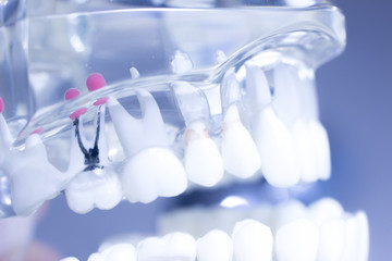 Dental teeth mouth model