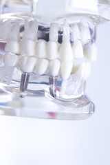Dentsts dental teeth model