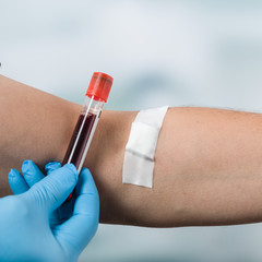 Hand mit Blutprobe neben einem Arm mit Pflaster  dem Blut abgenommen wurde