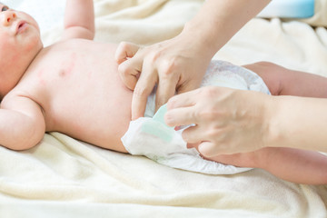 Mother putting diaper on her baby - obrazy, fototapety, plakaty