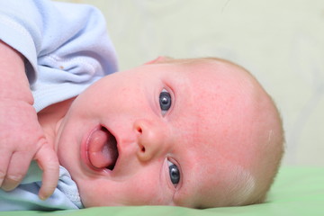 newborn baby allergy skin rash