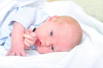 newborn baby allergy skin rash