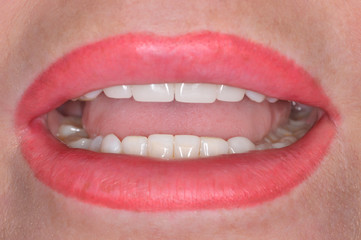 Close up of a patient's mouth at a dental clinic
