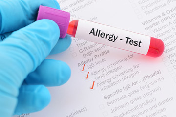 Blood sample with requisition form for allergy test