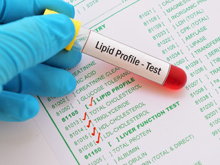 Blood sample with requisition form for lipid profile test